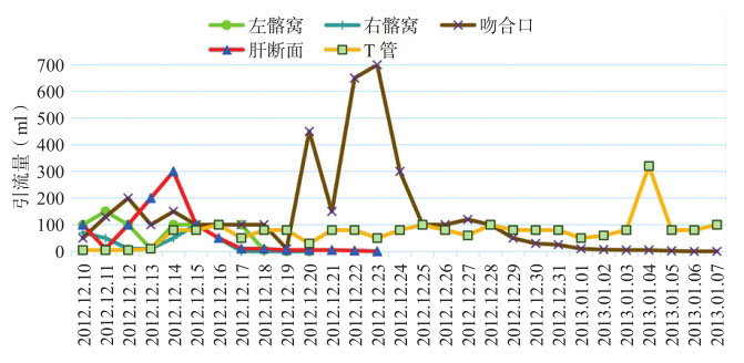 图6 第二次术后各引流管引流液情况
